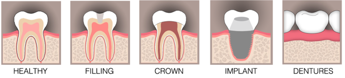 restorative-dentistry