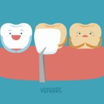 Teeth Veneers: Experience the Power of a Great Smile